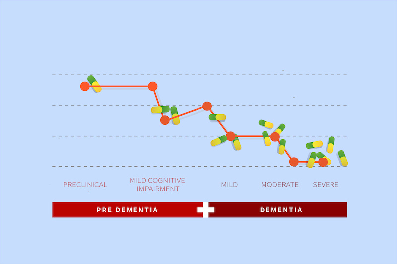 health infographics of dementia sufferers who are decreasing even though they have taken a lot of drugs. several stages of dementia, from preclinical to severe levels