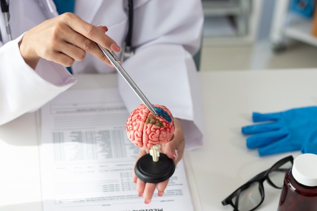 Alzheimer's disease Asian female doctor holds brain anatomy model for diagnosis and treatment, new modern clinic, complete tools to cure brain disease.
