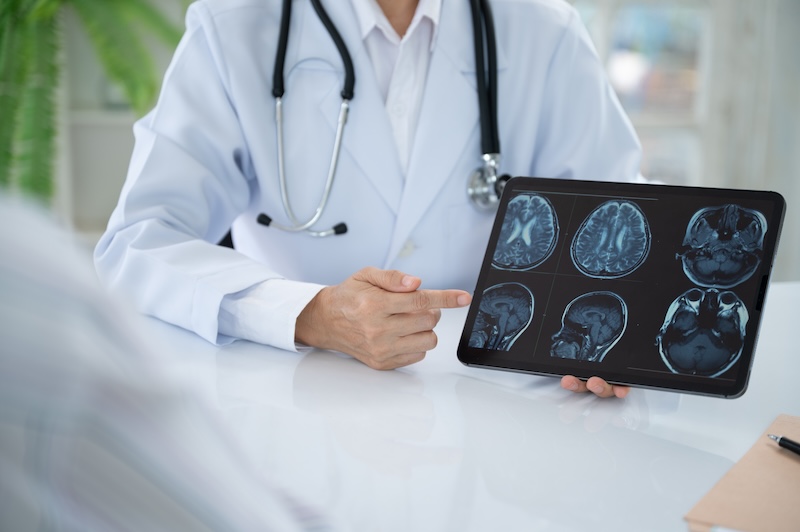 Neurologist Doctor treatment planning for diseases nervous system and brain with patient about cerebrovascular disease, migraine, epilepsy, Parkinson's disease, dementia and stroke at Neurology Center.